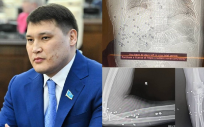 Руслан Берденовке атылған оқ: Полицейлер күдікке ілінді